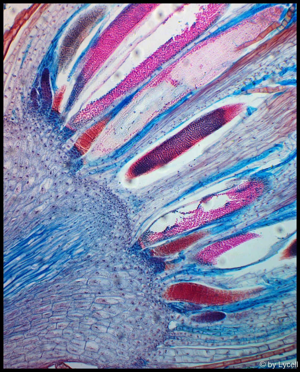 c007 moss antheridia.webp