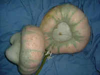 Kürbis 2010 (3).webp